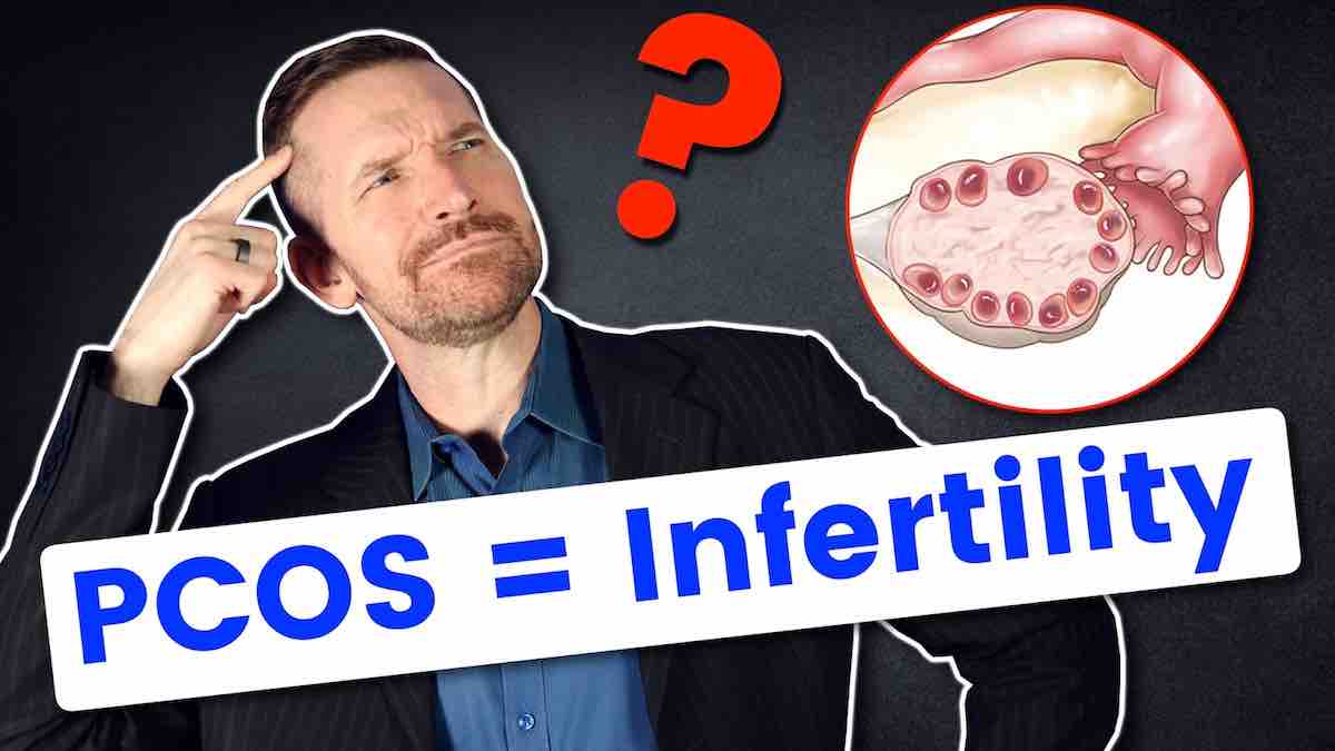PCOS - infertility